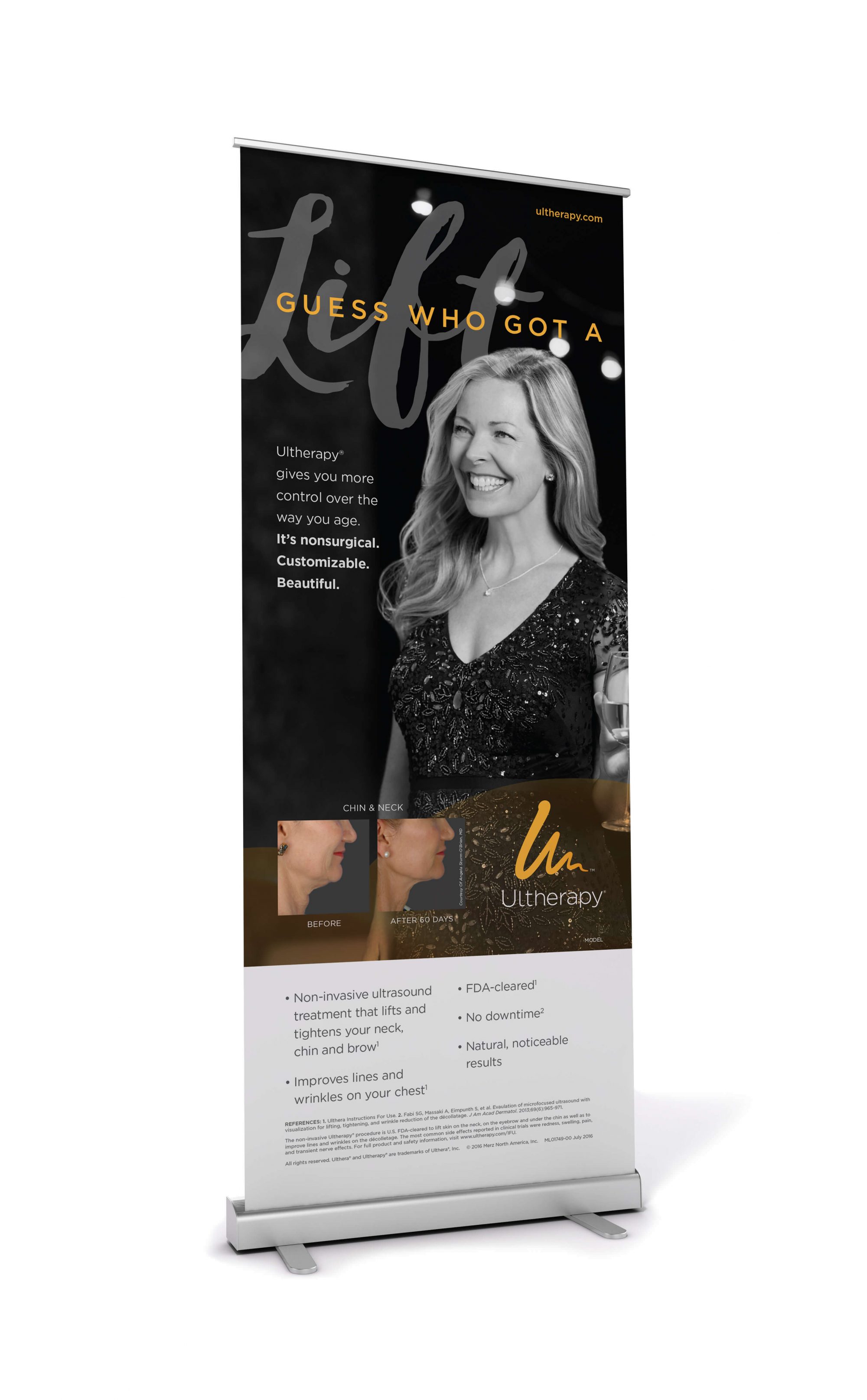 Ultherapy Banner Stand