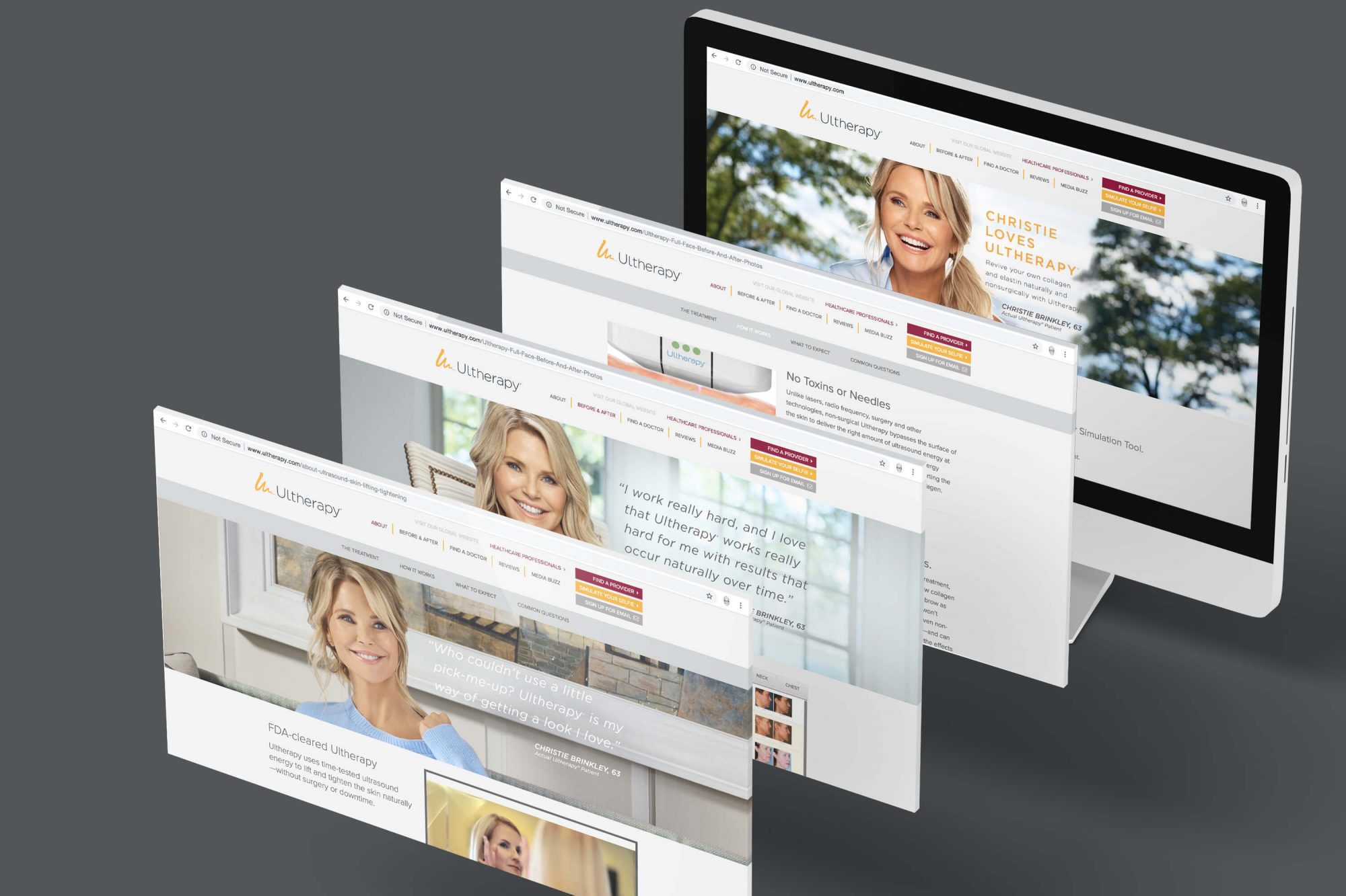 Ultherapy CB Website